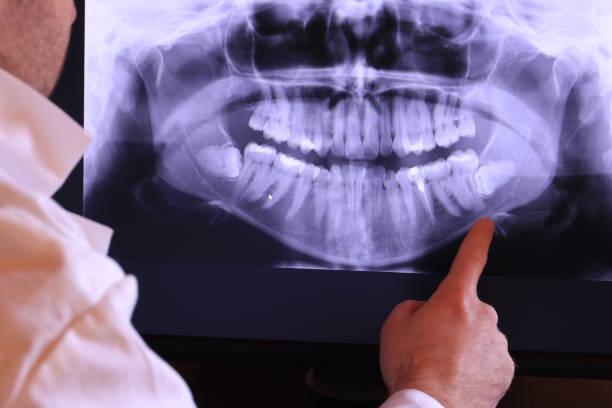 Best After-Hours Dental Trauma Care in East Quincy, CA