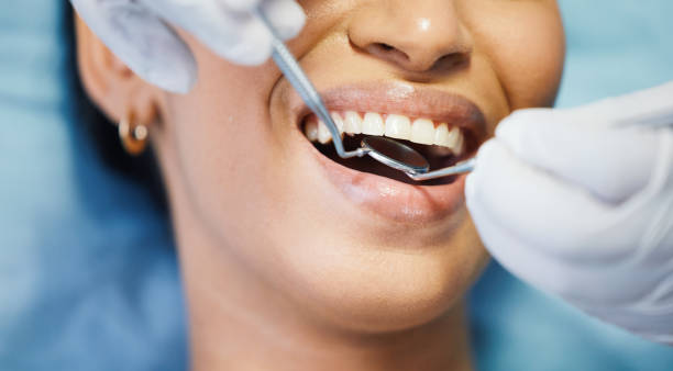 Best Emergency Tooth Extraction in East Quincy, CA
